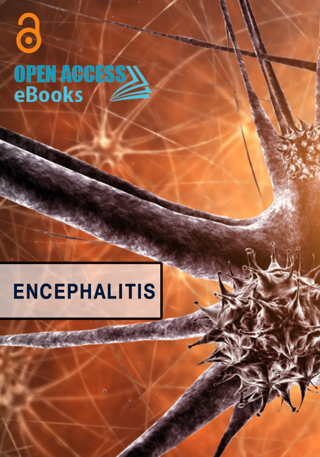 Encephalitis